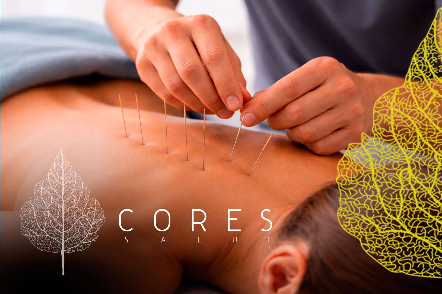 Centro Cores Salud - Punción Seca Cuenca