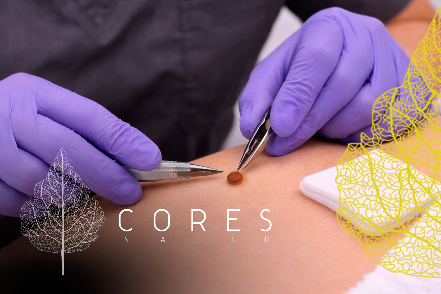 Centro Cores Salud - Cirugía Menor Cuenca