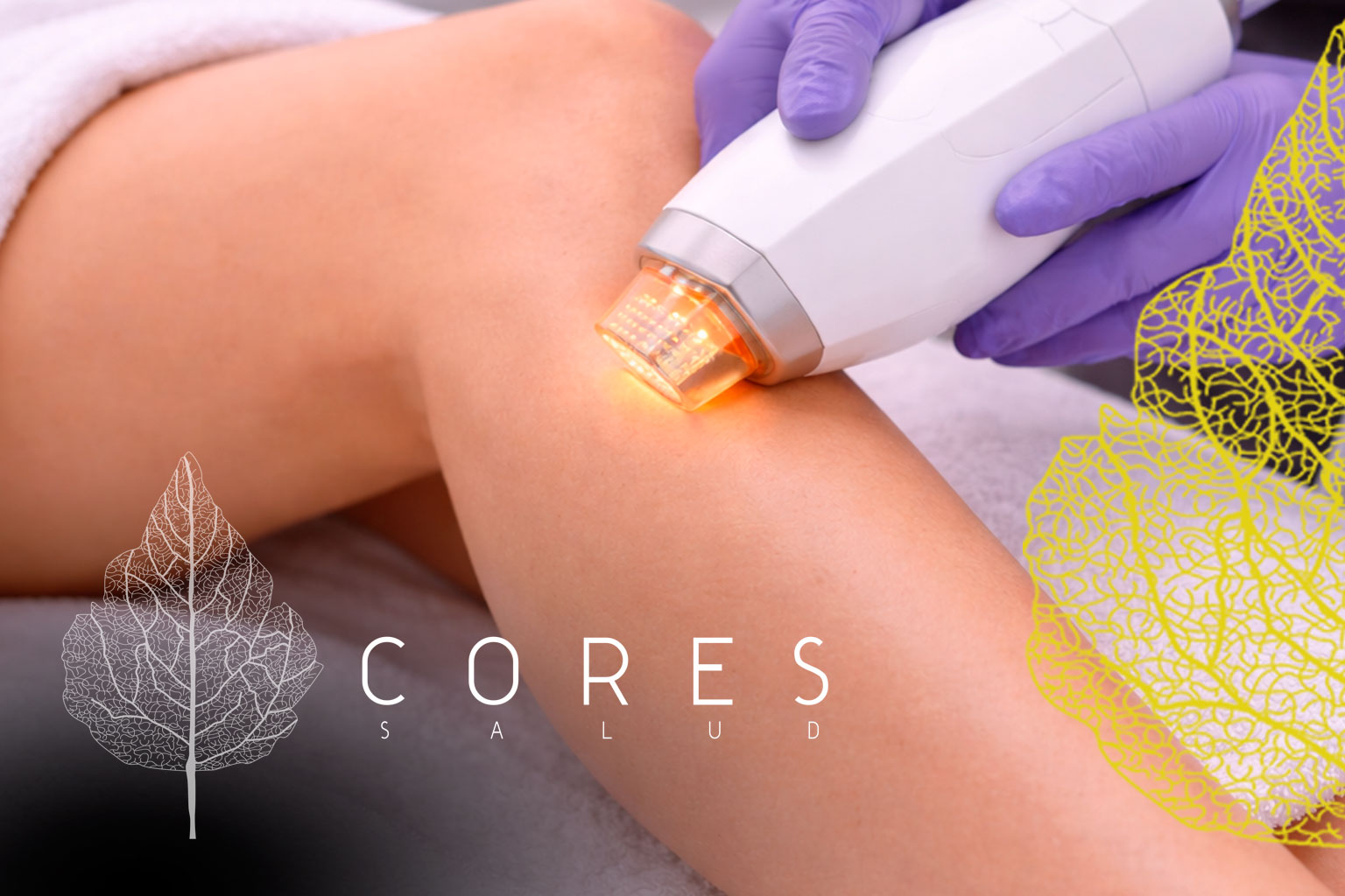 Depilación Láser Cuenca