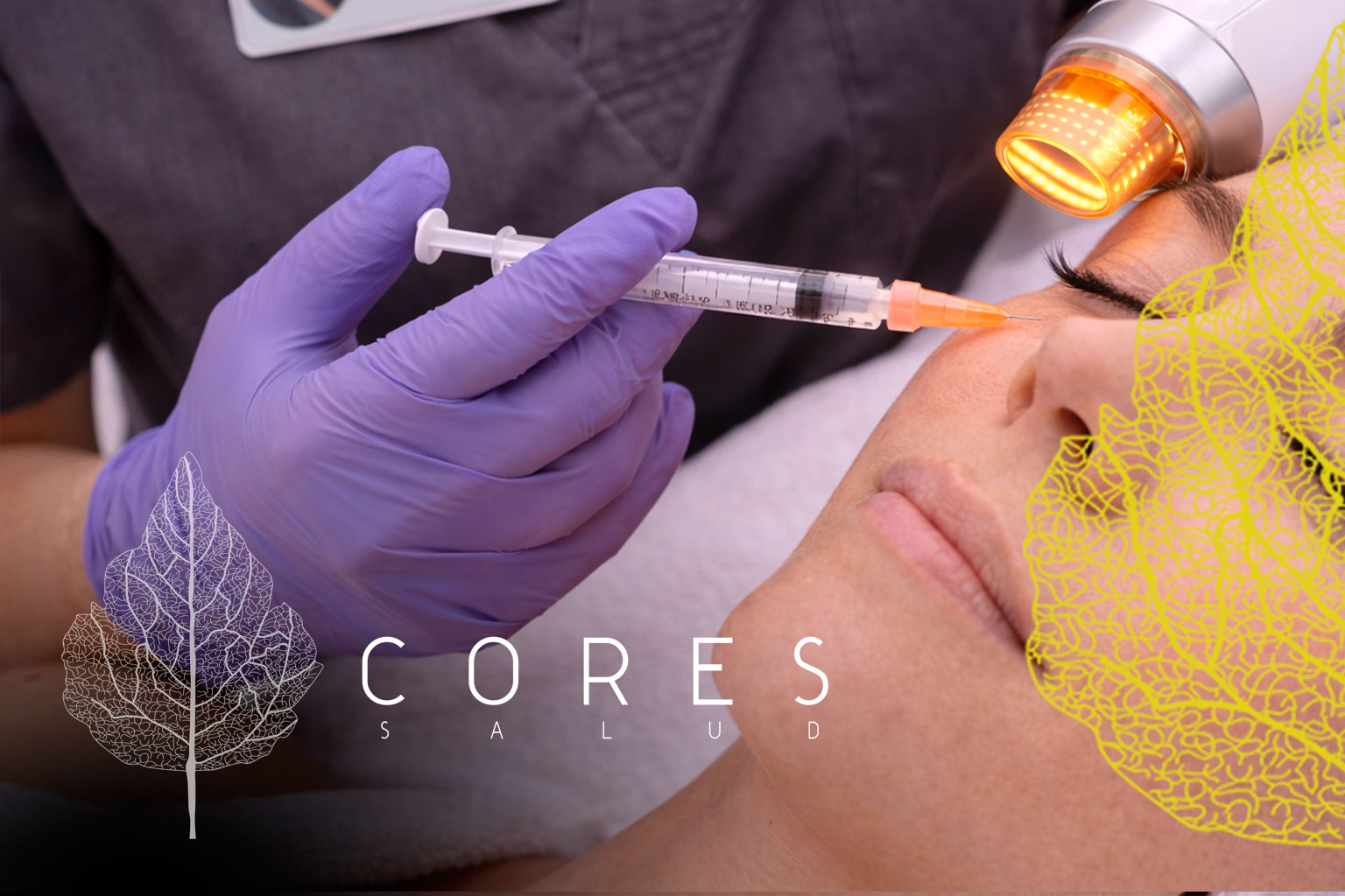 Corrección de arrugas en la piel en Cuenca